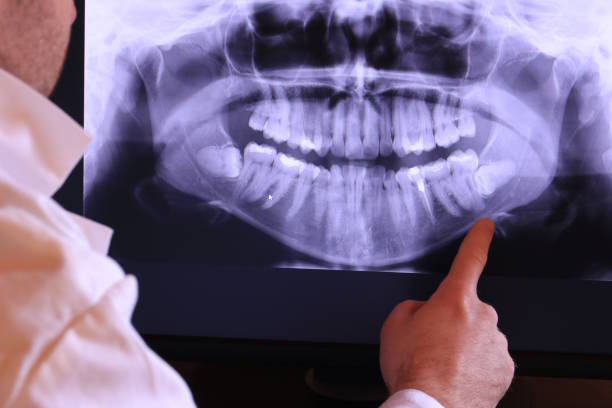 Best Emergency Treatment for Jaw Pain or Injury in Yonkers, NY