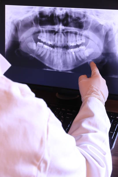 Best Emergency Treatment for Oral Infections in Yonkers, NY